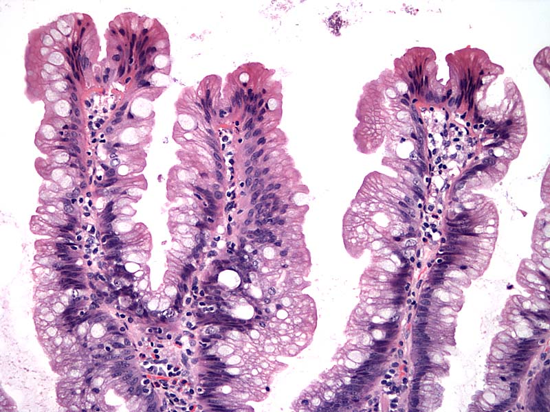 serrated-polyps-quiz