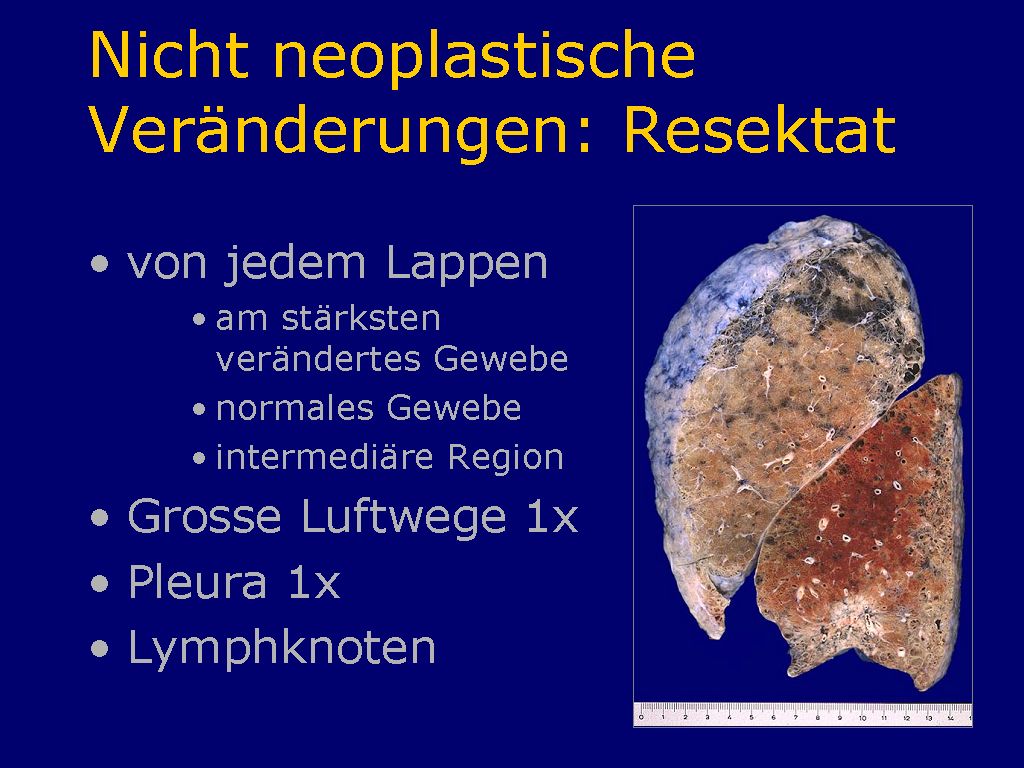 Nicht neoplastische Veränderungen Resektat